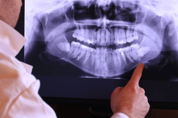 Best Emergency Denture Repair in Fritch, TX