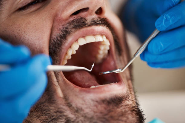 Best Emergency Treatment for Dental Infections or Abscesses in Fritch, TX
