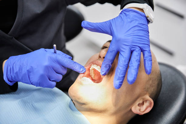 Best Emergency Tooth Extraction in Fritch, TX