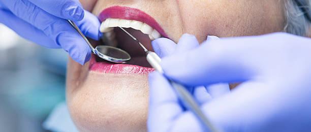 Best Emergency Wisdom Teeth Removal in Fritch, TX